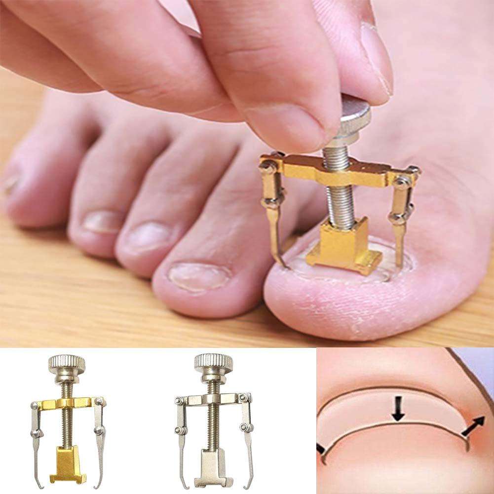 Ingrown Toenail Toe Fixer Recover Correction Device Pedicure Foot Nail Care Tool Easy to Use Инструменты по уходу за ногтями